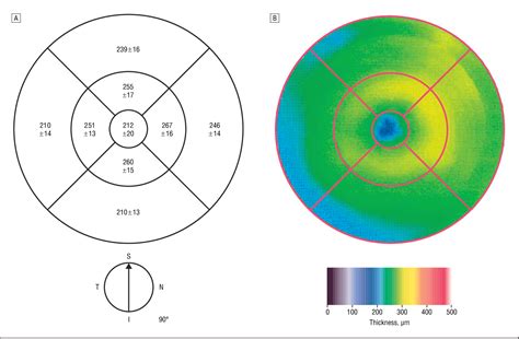 oct macular thickness measurements|central macular thickness normal range.